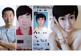 หยิกแขนฉันที ว่านี่ไม่ใช่ความฝัน! มหัศจรรย์ หนุ่มจีนศัลยกรรมเปลี่ยนเบ้า แบ๊วเว่อร์